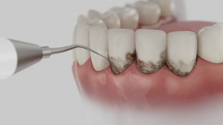Reliable Dental Implants contractor in Baden, MD by Smile Center Dentistry